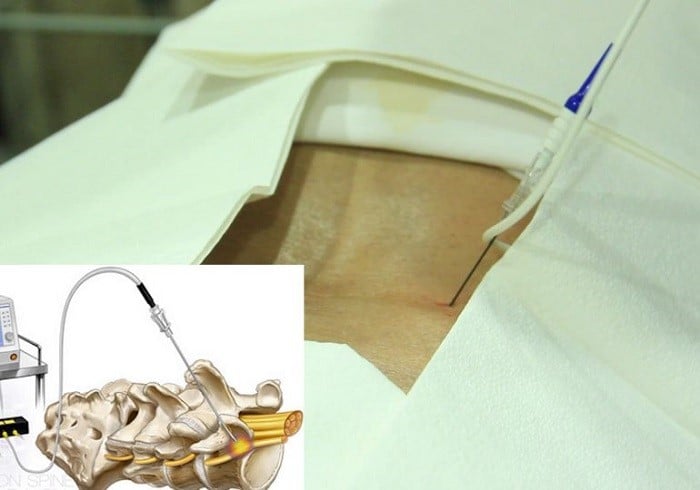 جراحان امیدوارند با این روش به چه نتیجه‌ای برسند