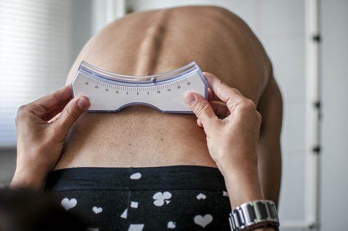 درمان گودی کمر