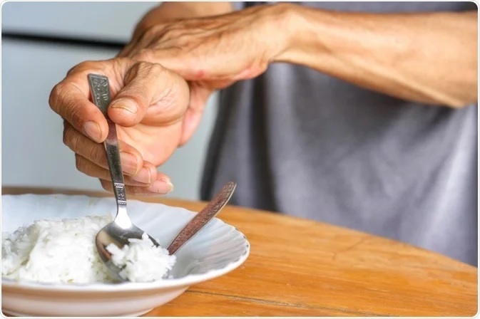 علائم بیماری پارکینسون