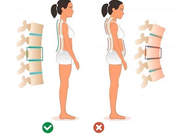 قوز پشتی چیست و چه عوارضی دارد؟