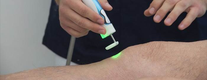 ویژگی‌های لیزر